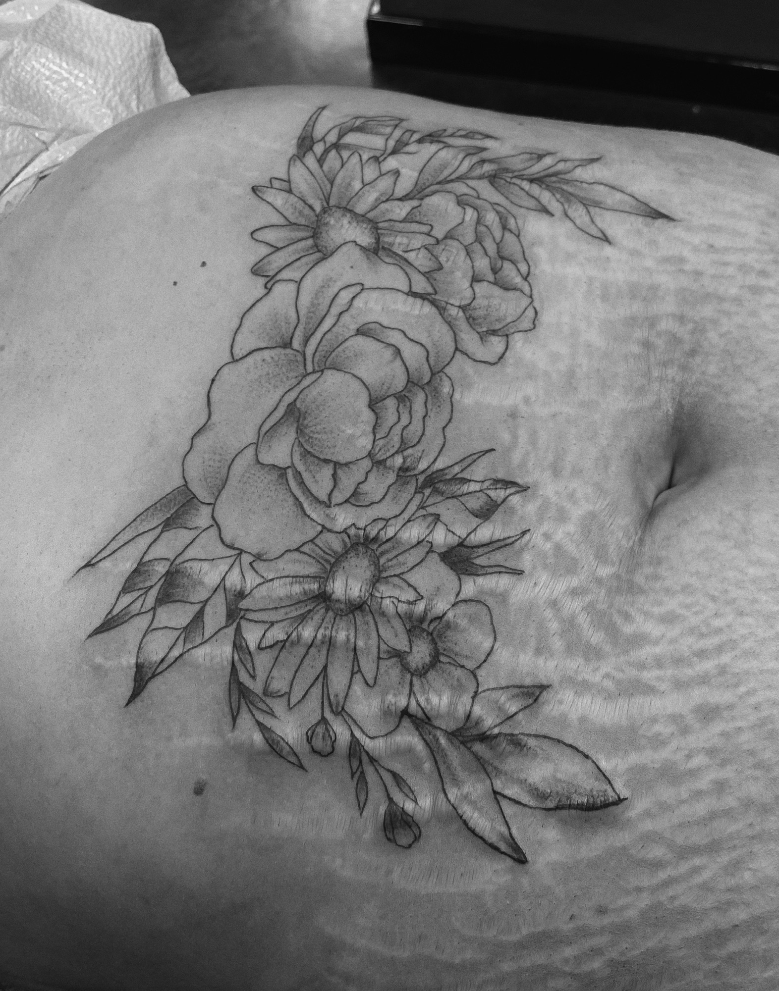 Stretch marks and tattoos – Things&Ink